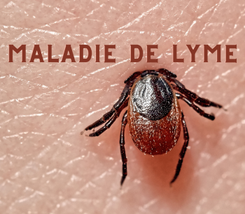 La maladie de Lyme est présente partout en Montérégie
